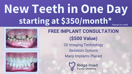 Cost of Dental Implants - Best Implant & Dentures Dentist in the Cleveland  Area